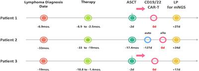 Case report: Acute HHV6B encephalitis/myelitis post CAR-T cell therapy in patients with relapsed/refractory aggressive B-cell lymphoma